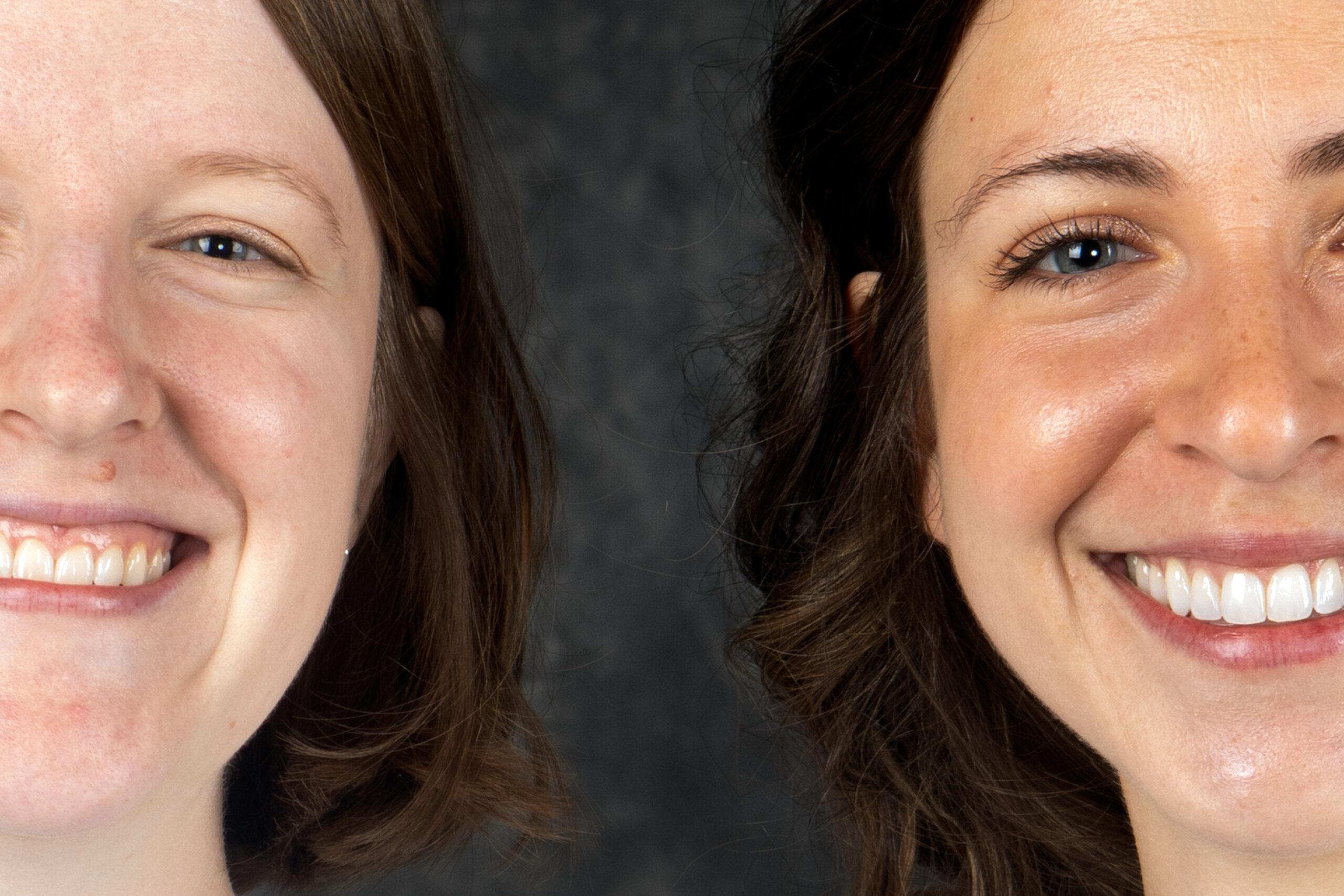 Laura Traister<br> and<br> Erin Walters